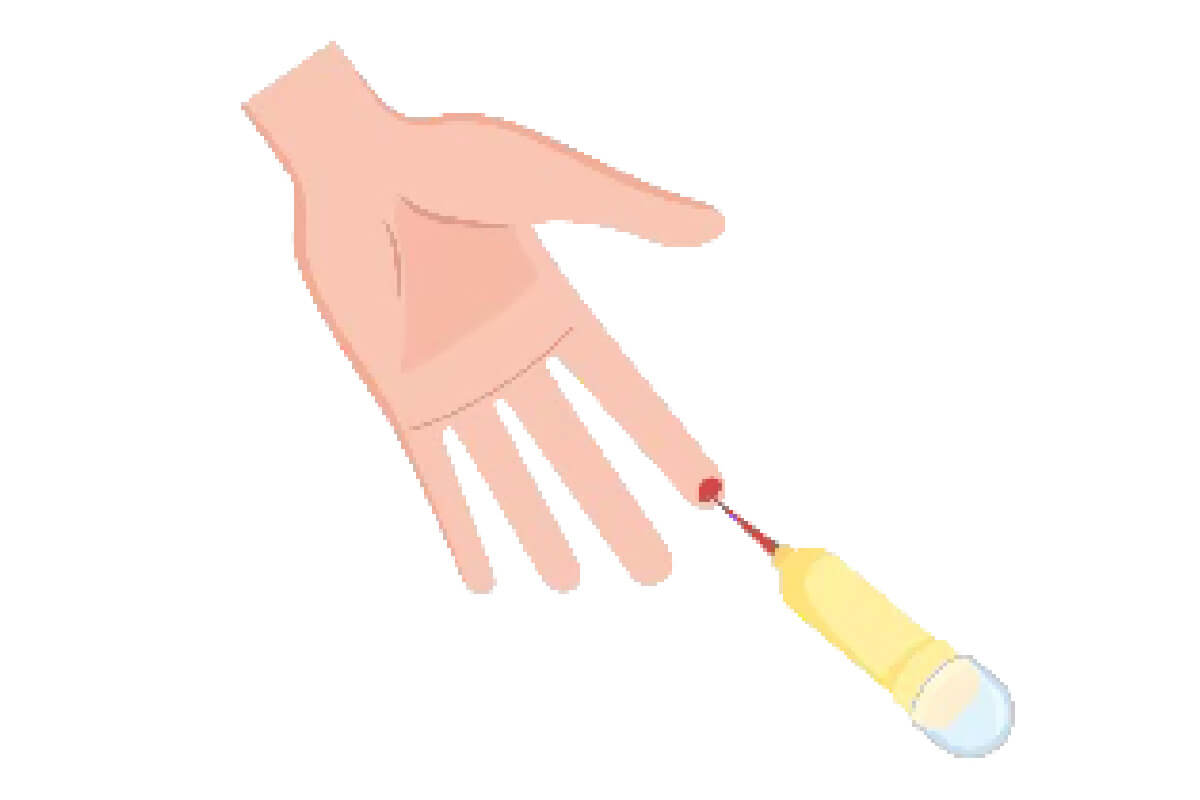 採血（20&micro;L）